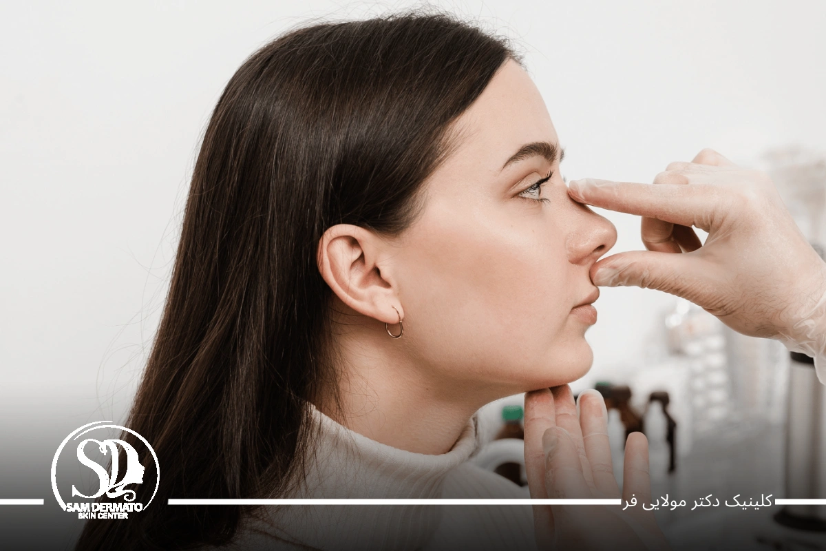اندولیفت بینی