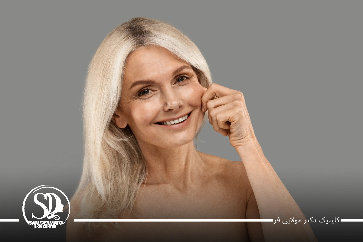 اندولیفت گونه