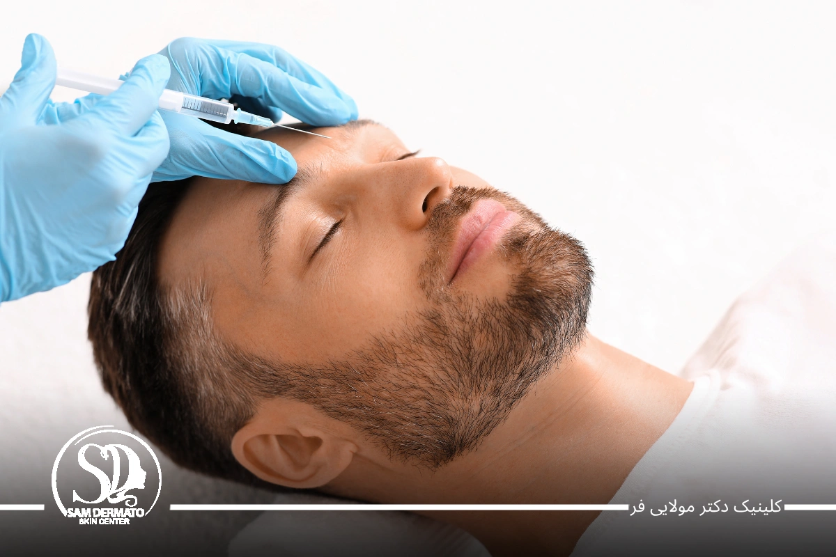 اندولیفت خط اخم