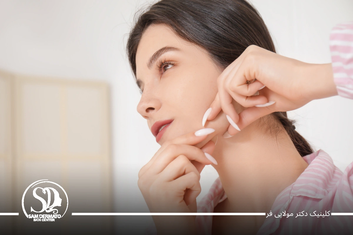 اندولیفت خط فک