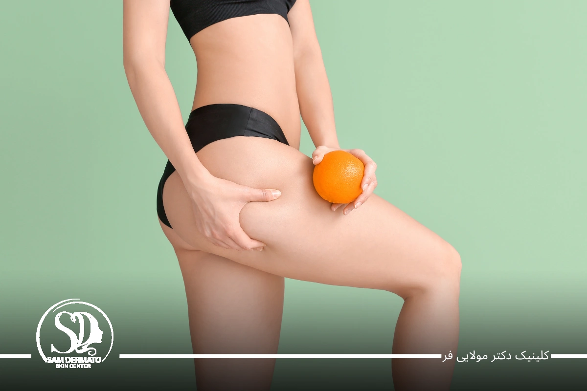 اندولیفت باسن