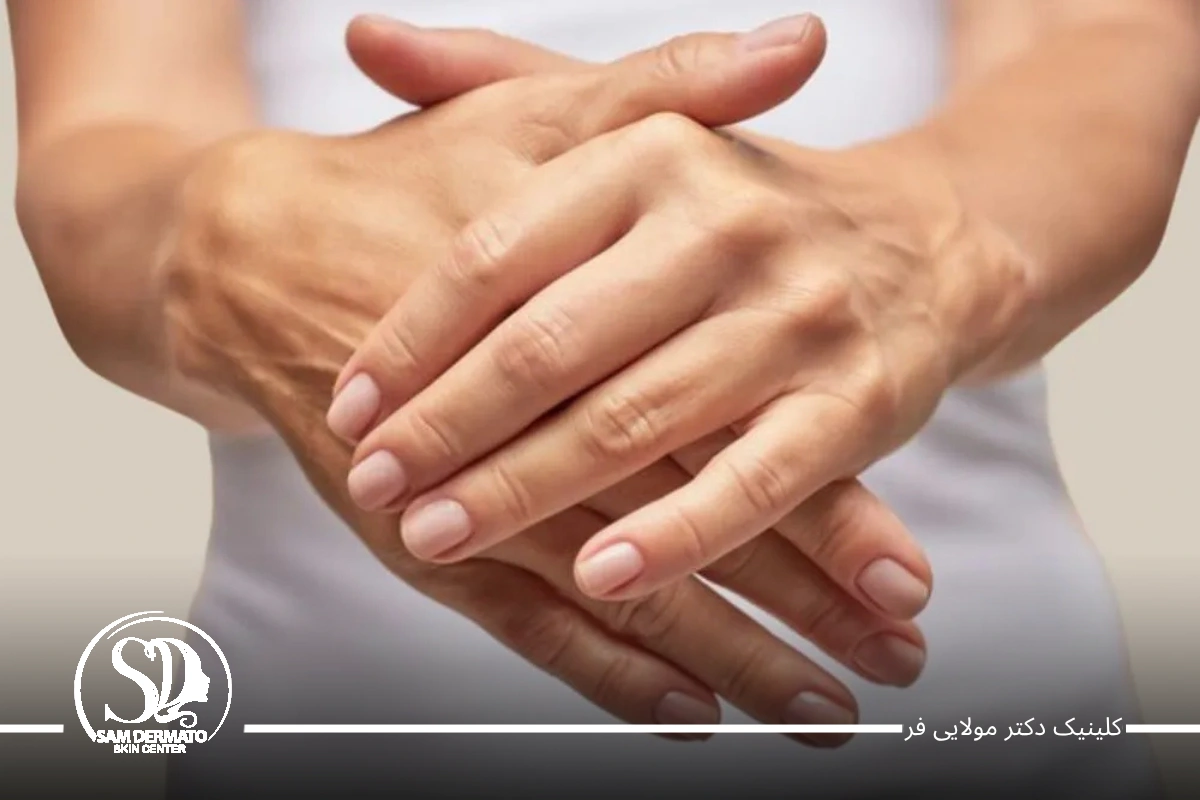 اندولیفت دست