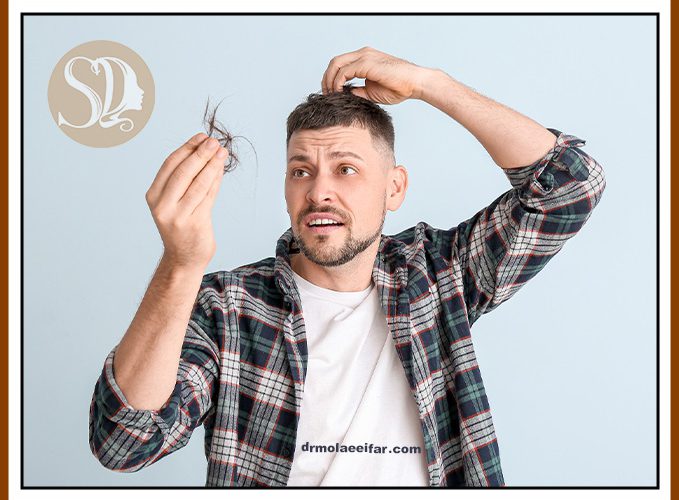 Treatment of male hair loss