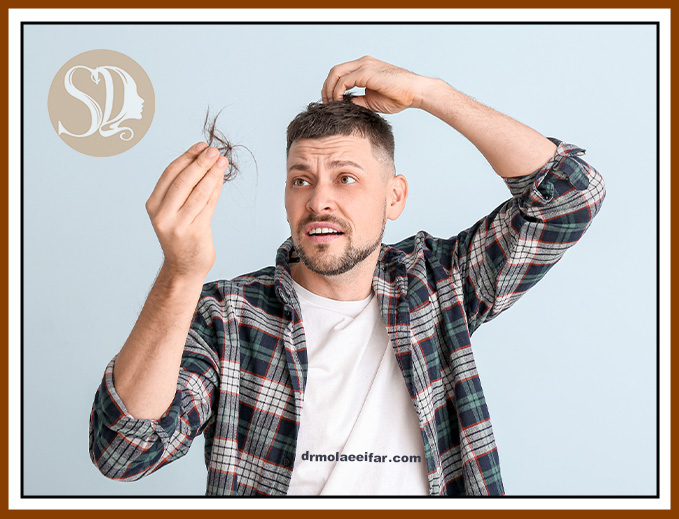 Treatment of male hair loss