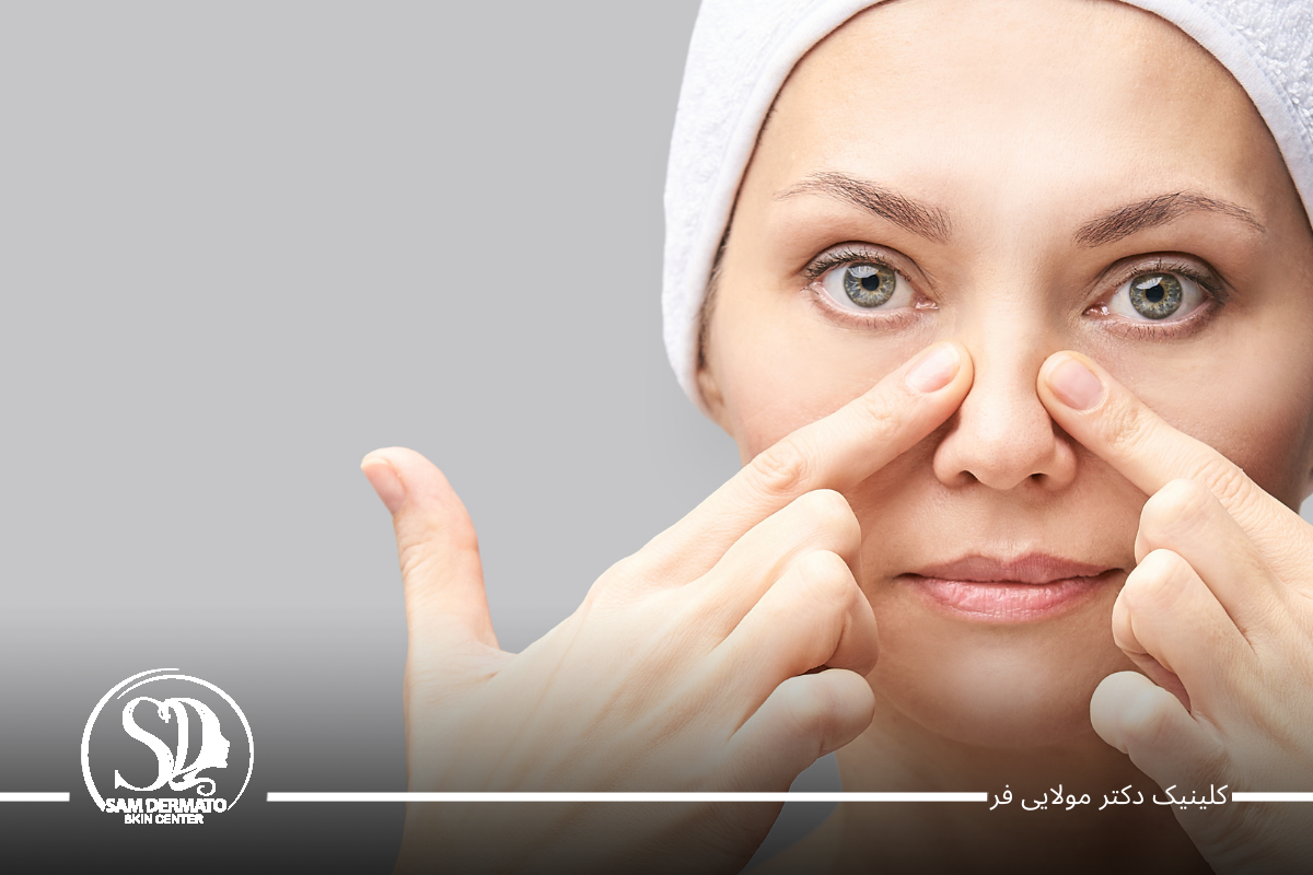 اندولیفت بینی گوشتی،اصلاح فرم بدون درد 6 اندولیفت بینی گوشتی