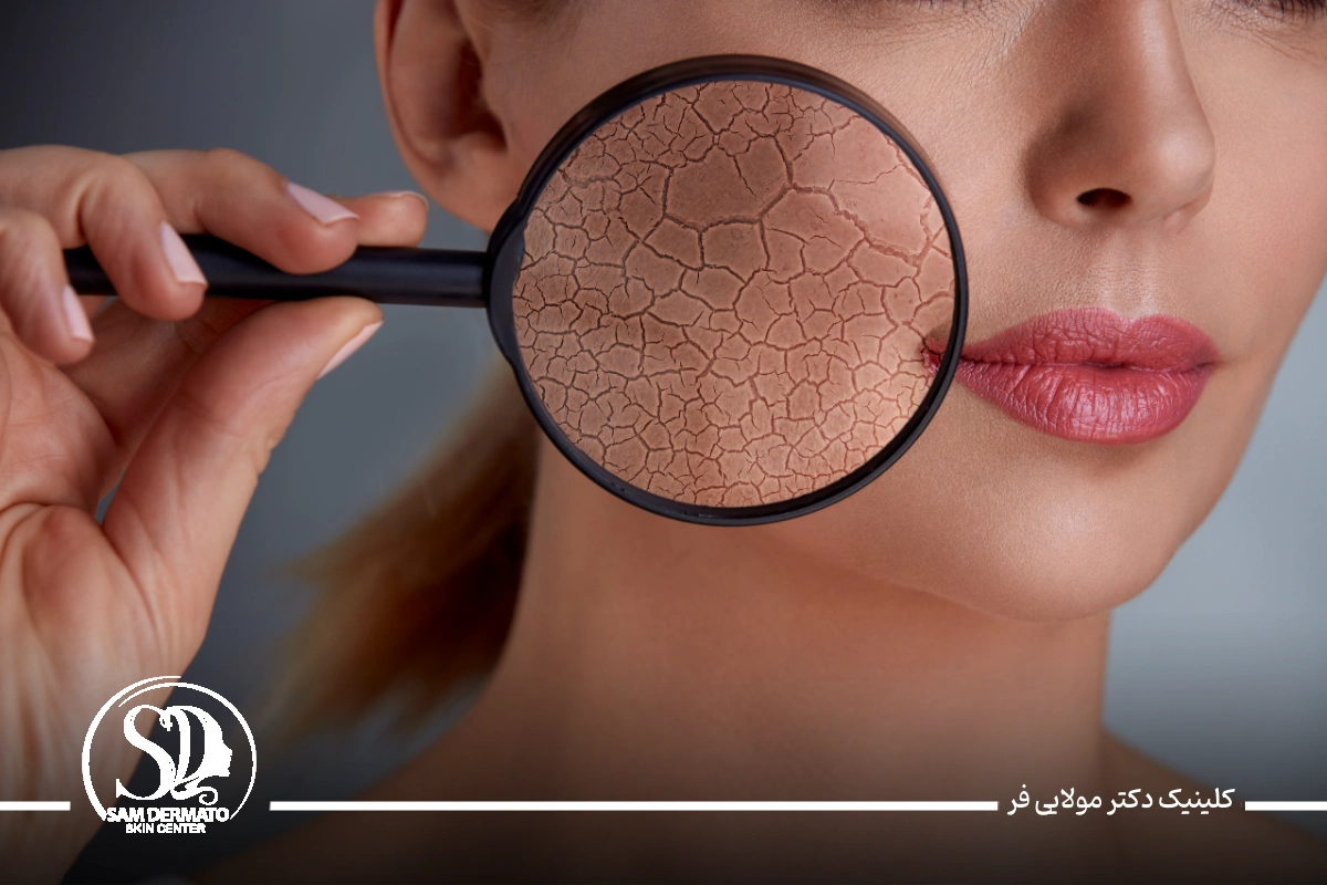 بهترین دکتر اندولیفت در تهران