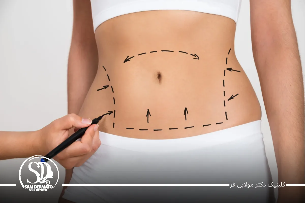 چرا کلینیک دکتر مولایی فر، بهترین مرکز اندولیفت تهران است؟