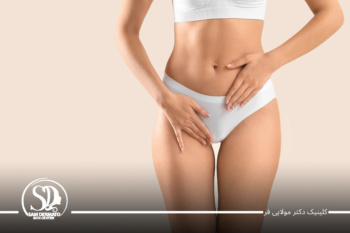 اندولیفت زیر شکم