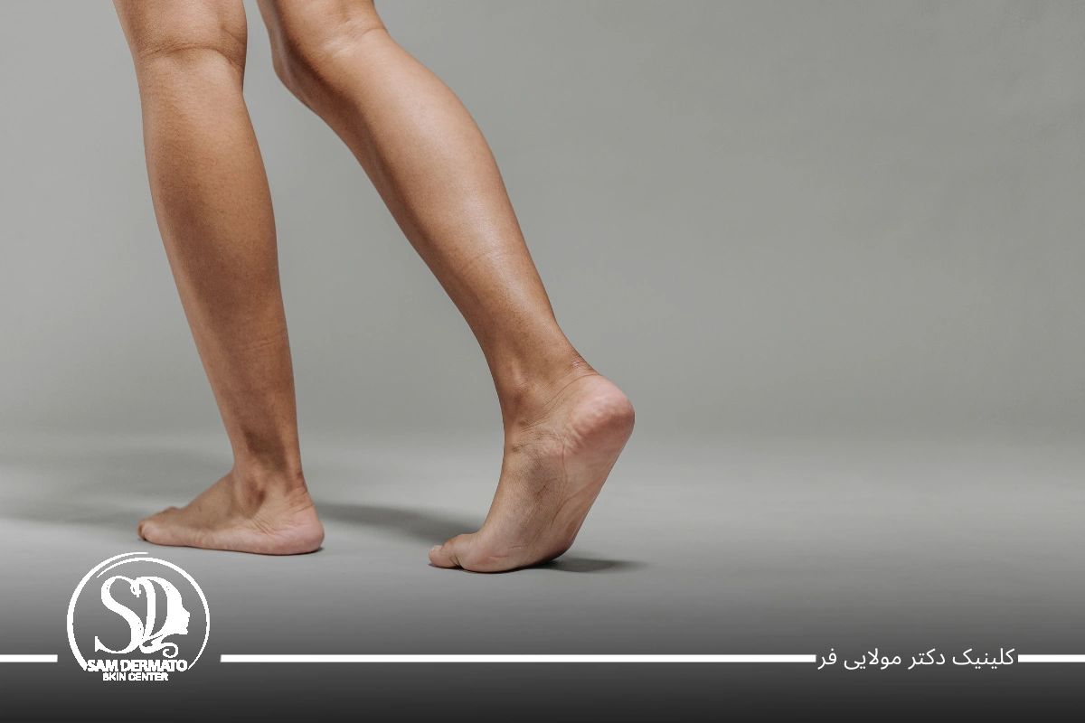 اندولیفت ساق پا
