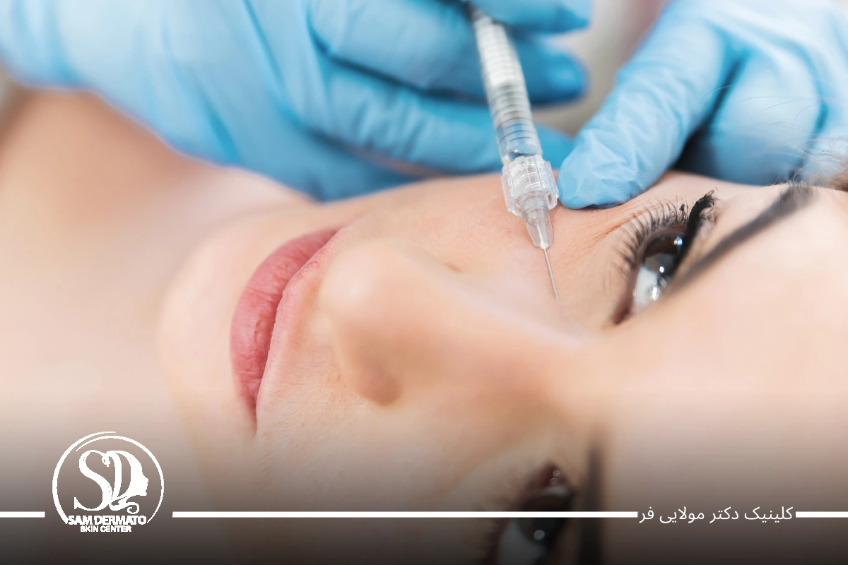 برطرف کردن سیاهی دور چشم