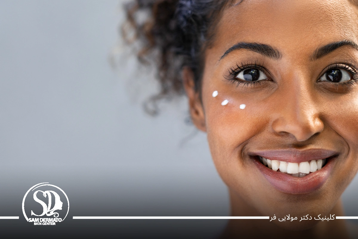 مزوژل زیر چشم