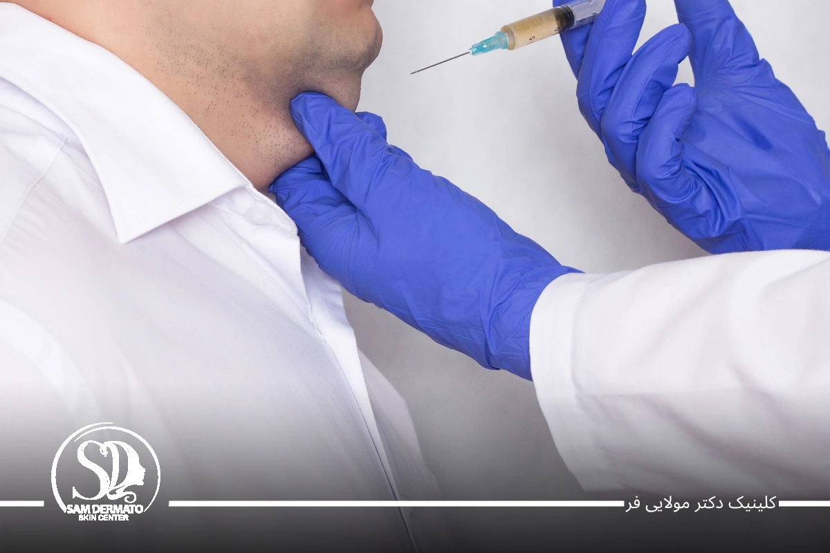 رفع دائمی غبغب