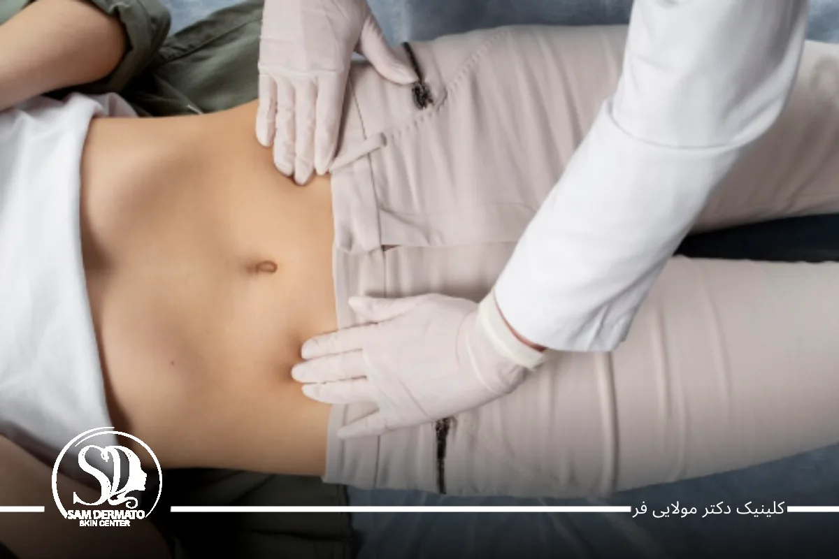 3. ورزش؛ اما نه فقط حرکات شکمی