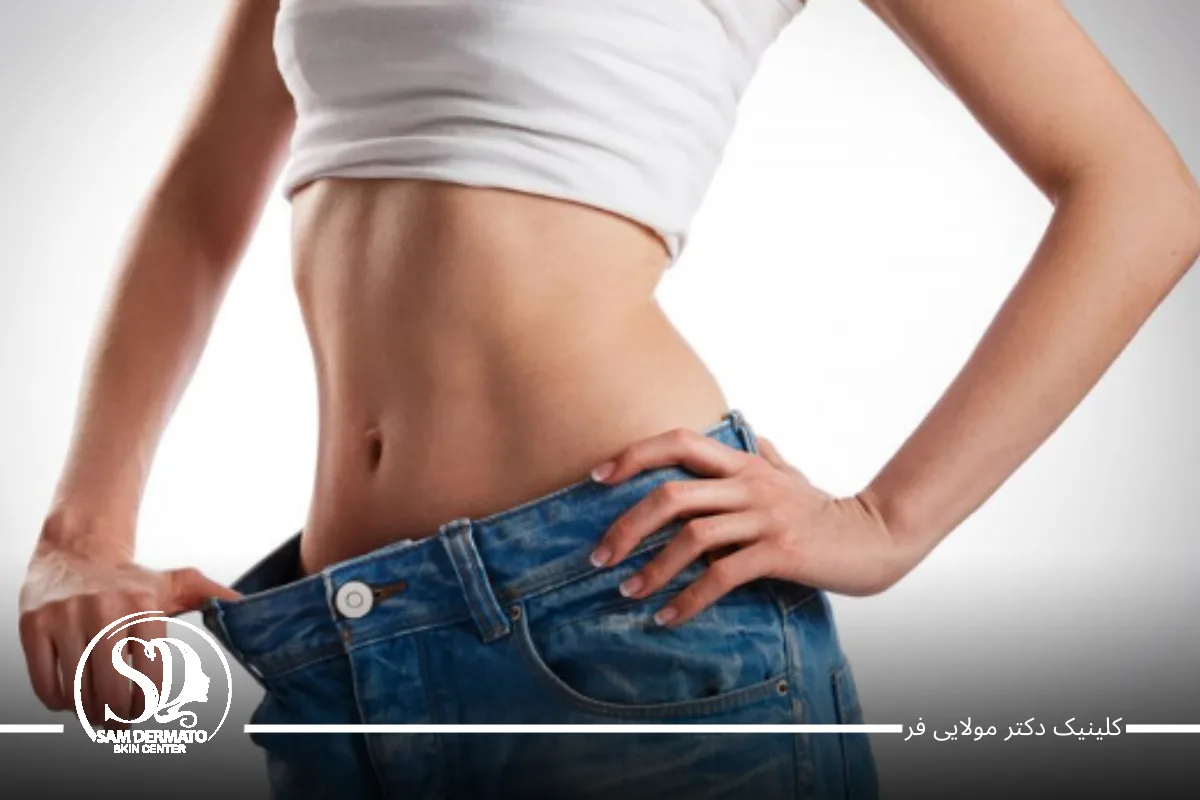 اندولیفت شکم برای چه کسانی مناسب است؟