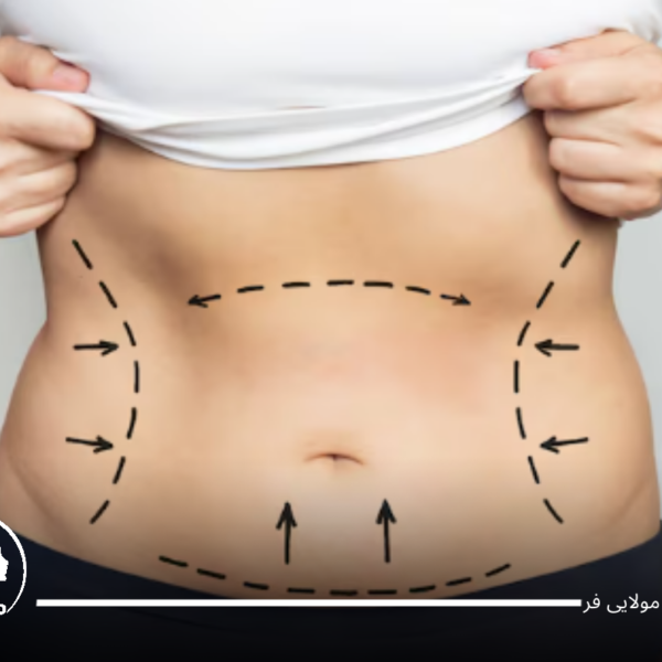 بی رحم ترین چربی سوز شکم و پهلو