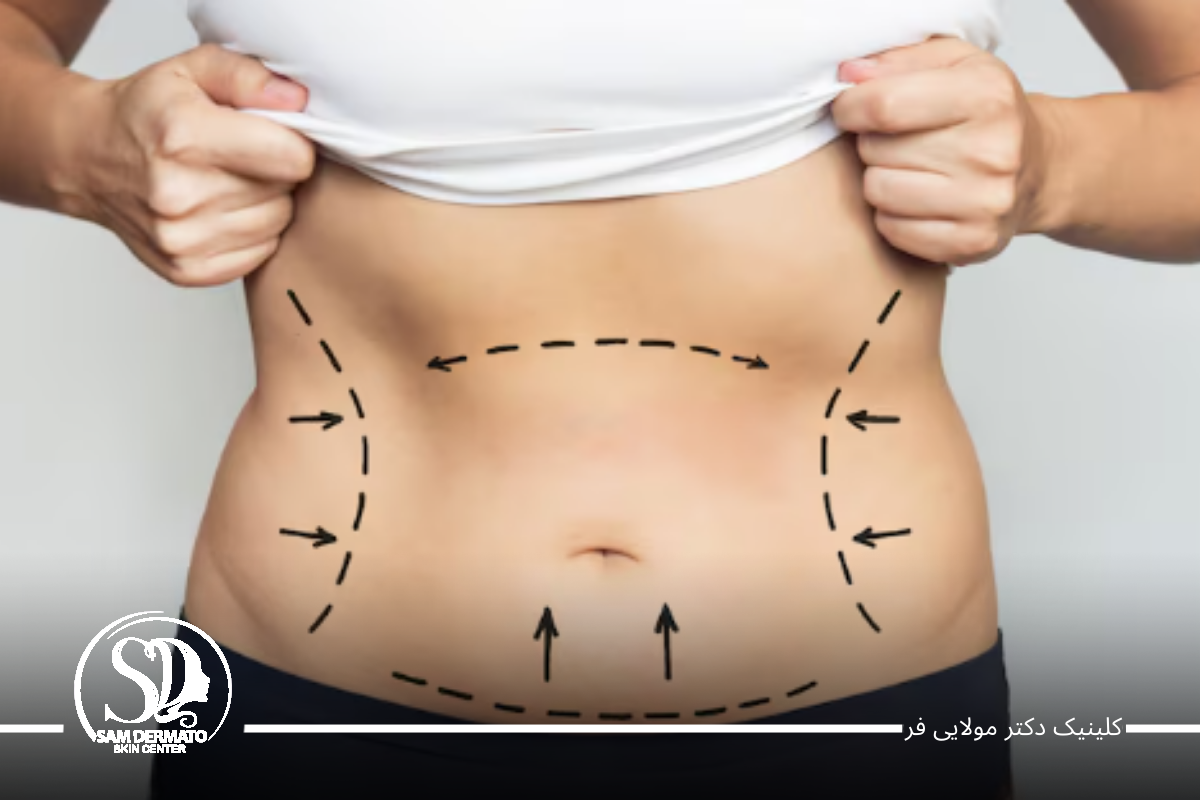 بی رحم ترین چربی سوز شکم و پهلو