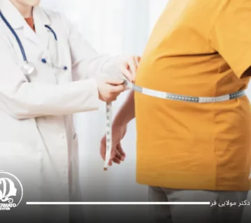 درمان چاقی شکم