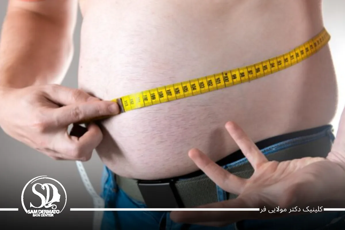 درمان چاقی شکم در کلینیک دکتر مولایی ‌فر