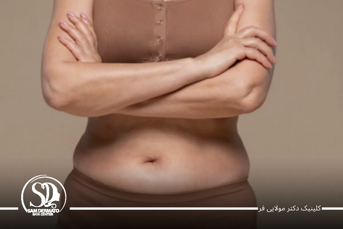 ریشه‌ی چاقی شکم از کجاست؟