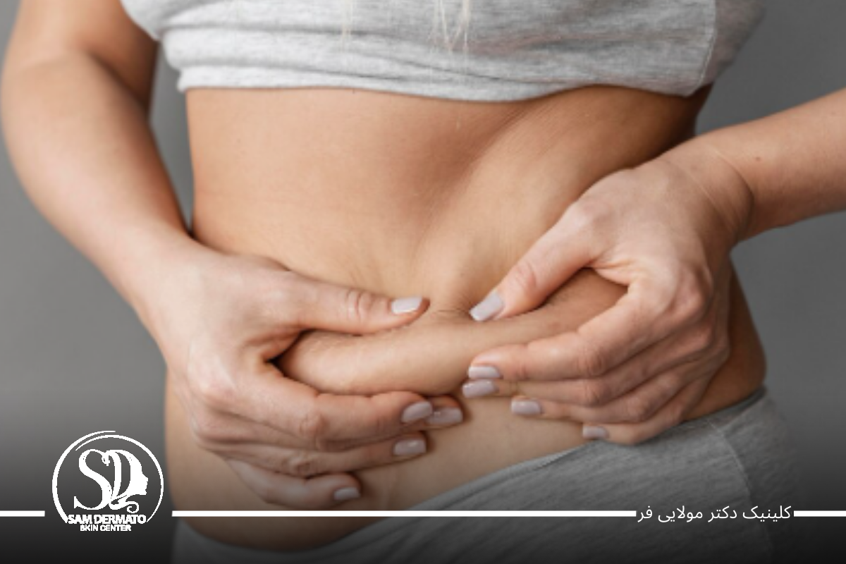 قرص‌ها و مکمل‌های لاغری؛ انتخاب سریع اما خطرناک