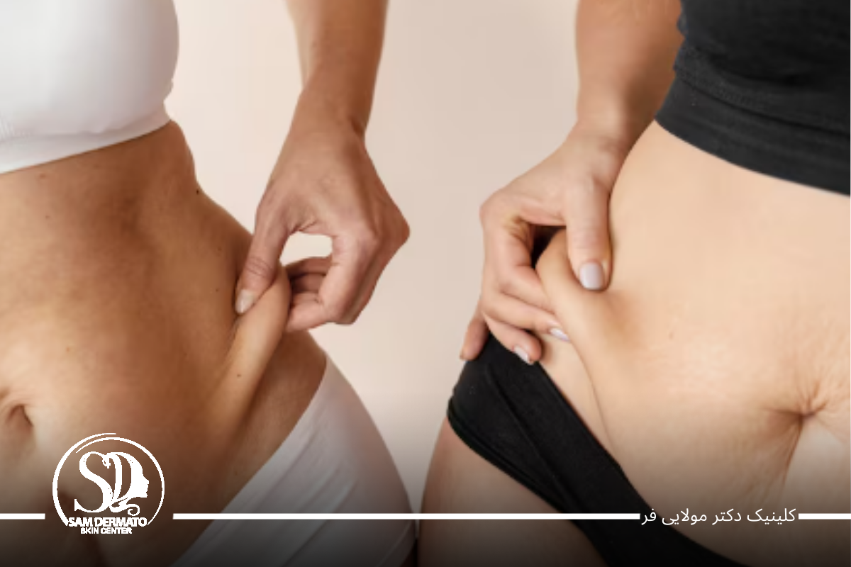 نکات طلایی برای نتیجه از سریع ‌ترین راه لاغری شکم و پهلو