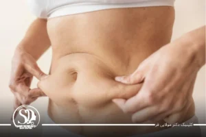 چگونه شکم خود را کوچک کنیم؟