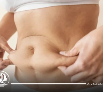 چگونه شکم خود را کوچک کنیم؟