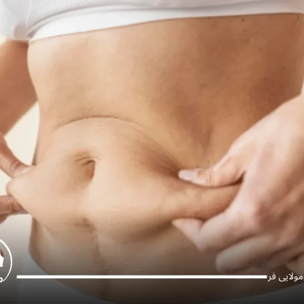 چگونه شکم خود را کوچک کنیم؟
