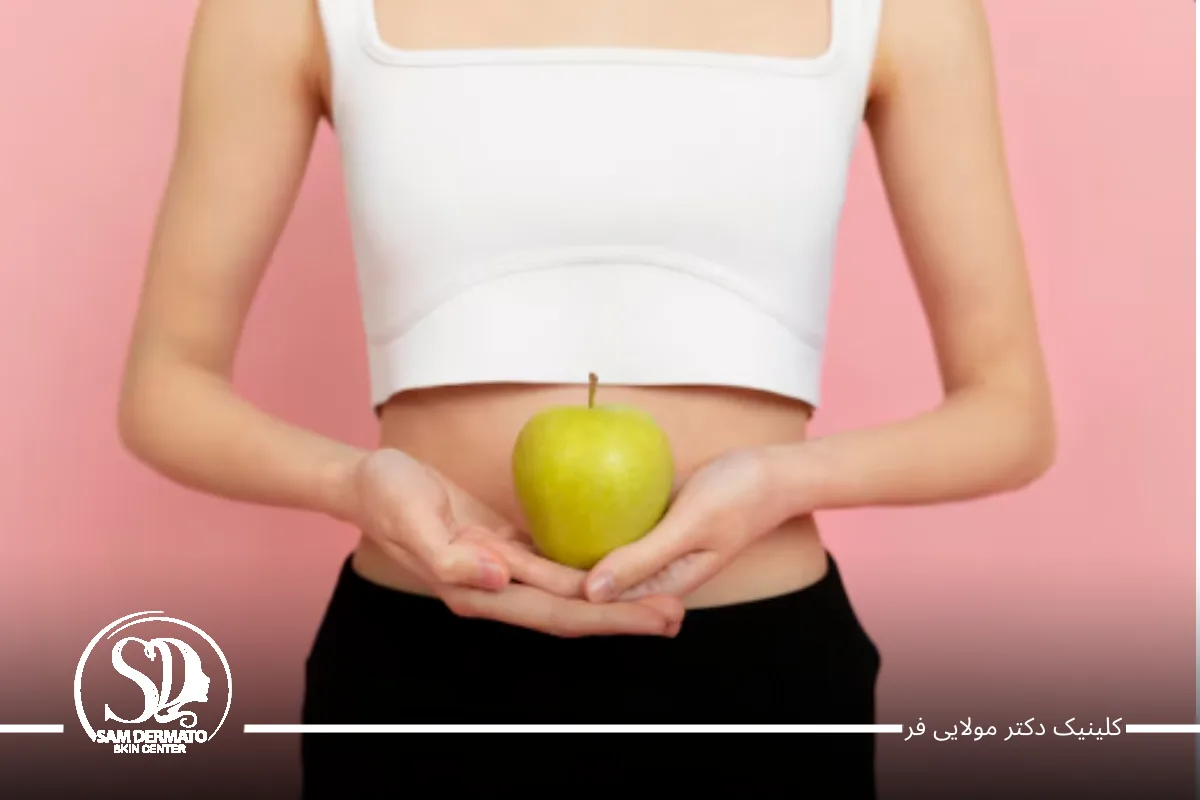 کویتیشن