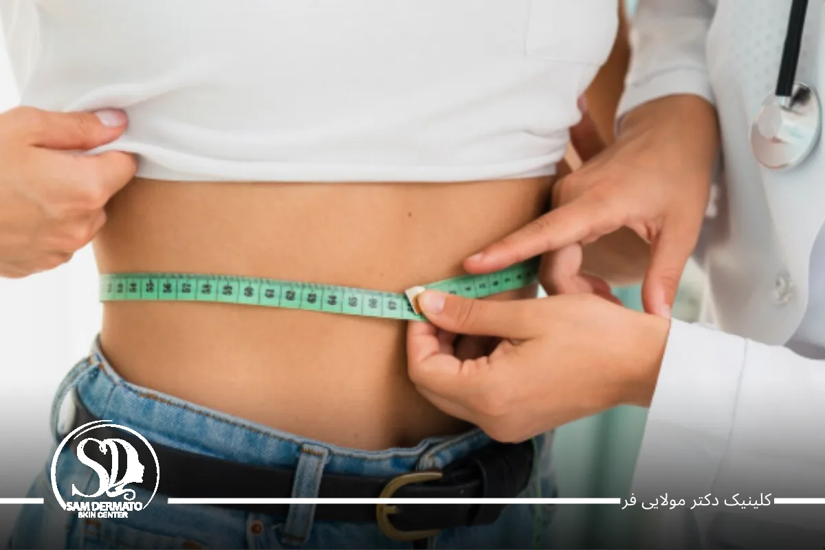 ۲. اصلاح تغذیه و مدیریت کالری