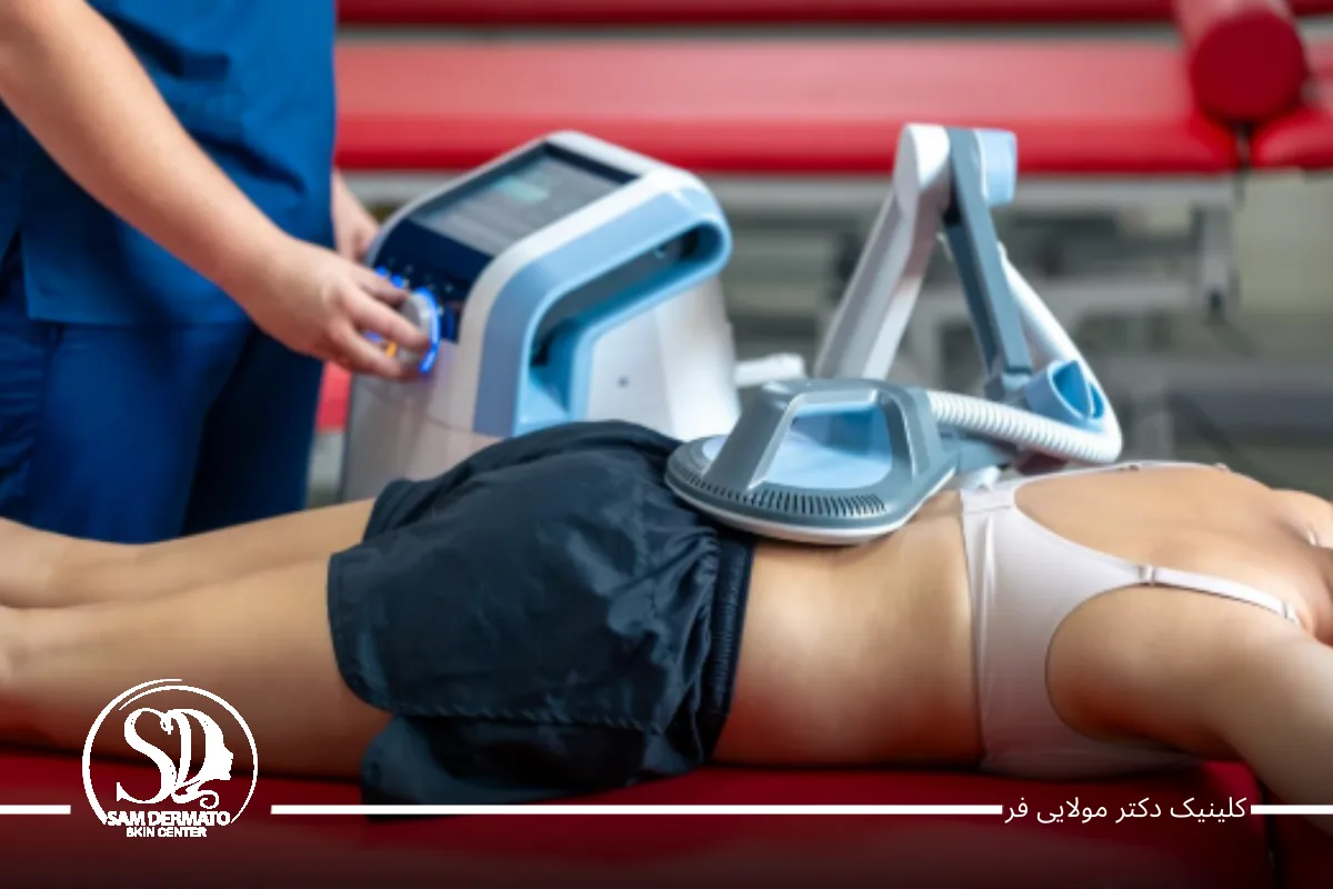 ۲. کرایولیپولیز – حذف چربی با تکنیک سرمای شدید