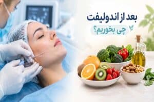 دکتر مولایی فر 53 بعد از اندولیفت چی بخوریم؟