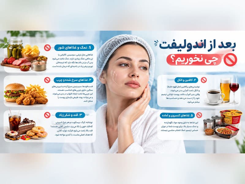 بعد از اندولیفت چی نخوریم؟