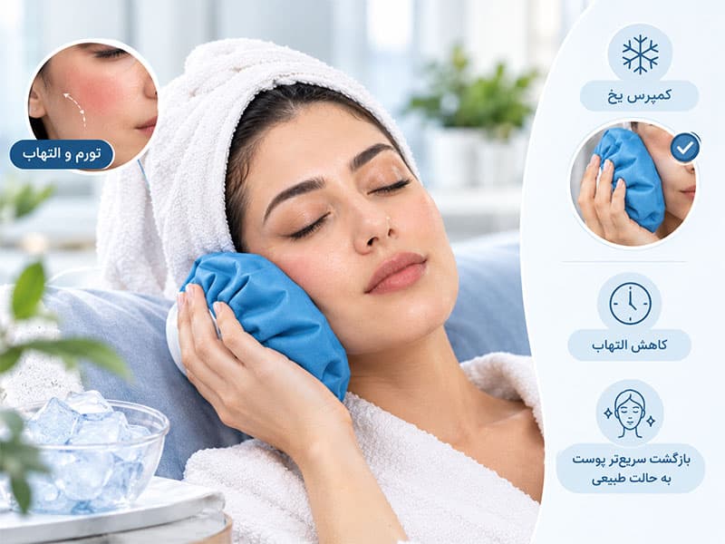 مدیریت تورم و التهاب در روزهای اولیه بعد از اندولیفت