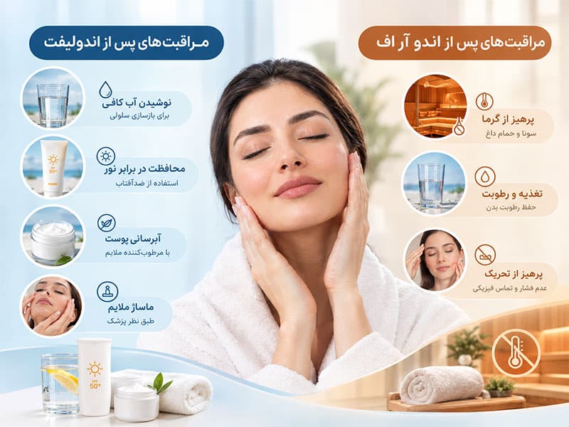 مراقبت‌های پس از اندولیفت و اندو آر اف