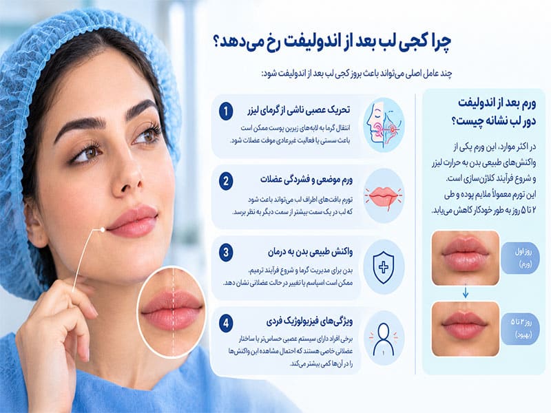 ورم بعد از اندولیفت دور لب