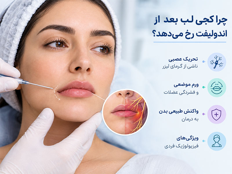 چرا کجی لب بعد از اندولیفت رخ می دهد؟