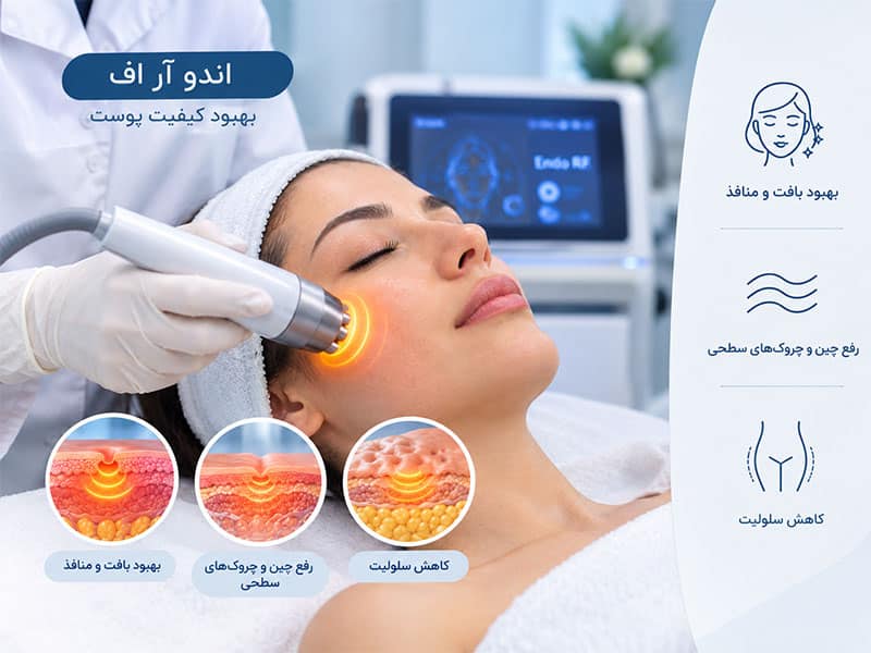 کاربردهای اندو آر اف