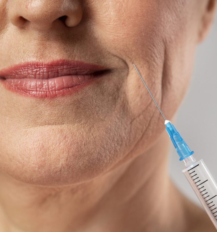 smiley-elder-woman-using-injection-her-mouth-wrinkles